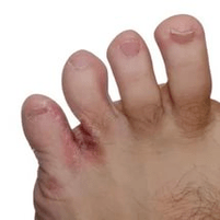 Cogomelo entre os dedos