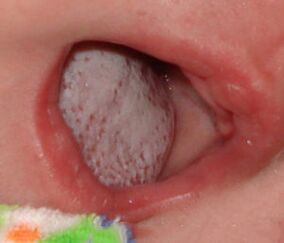 Localización da enfermidade cun cogomelo